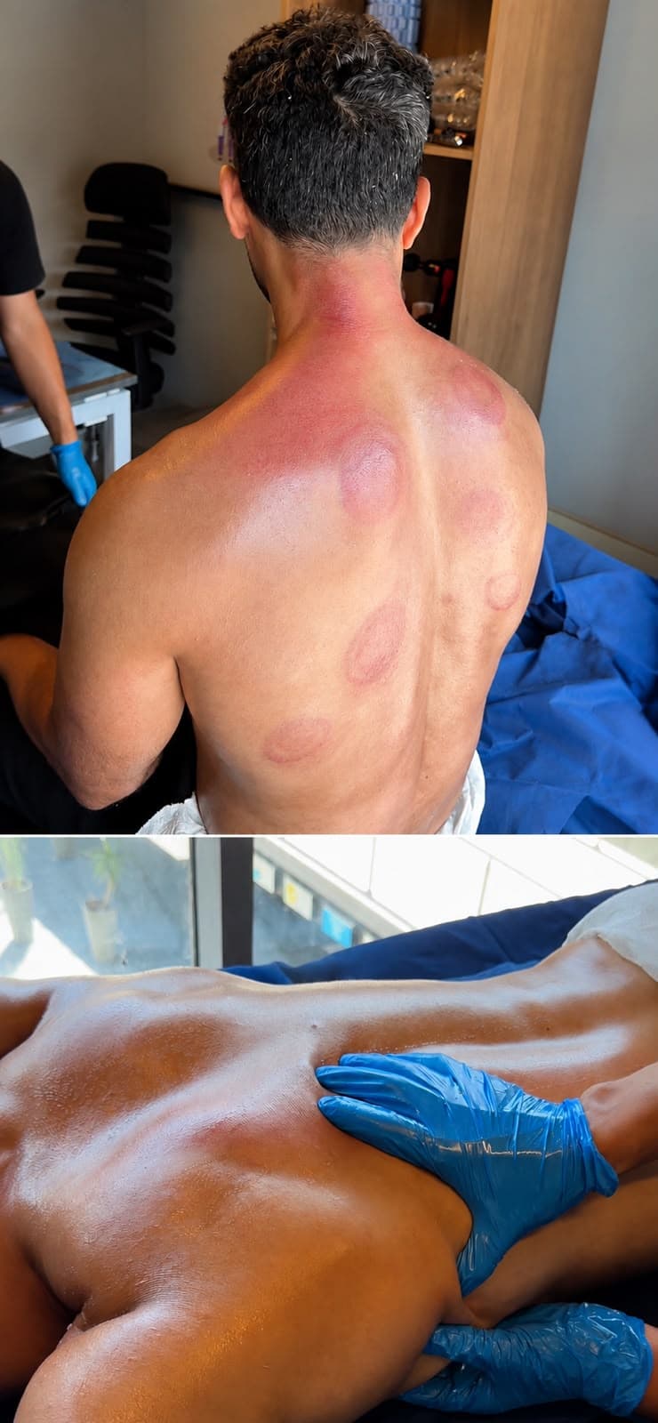 A muscle recovery session at Oriana Clinic